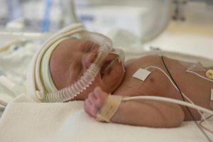 baby in incubator